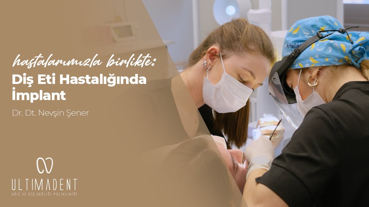 Diş Eti Hastalığında İmplant