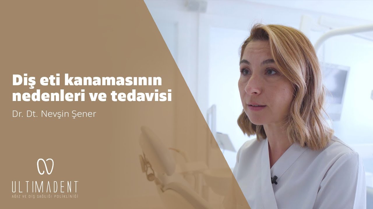 Diş Eti Kanamasının Nedenleri ve Tedavisi - UltimaDent - Dr. Dt. Nevşin Şener