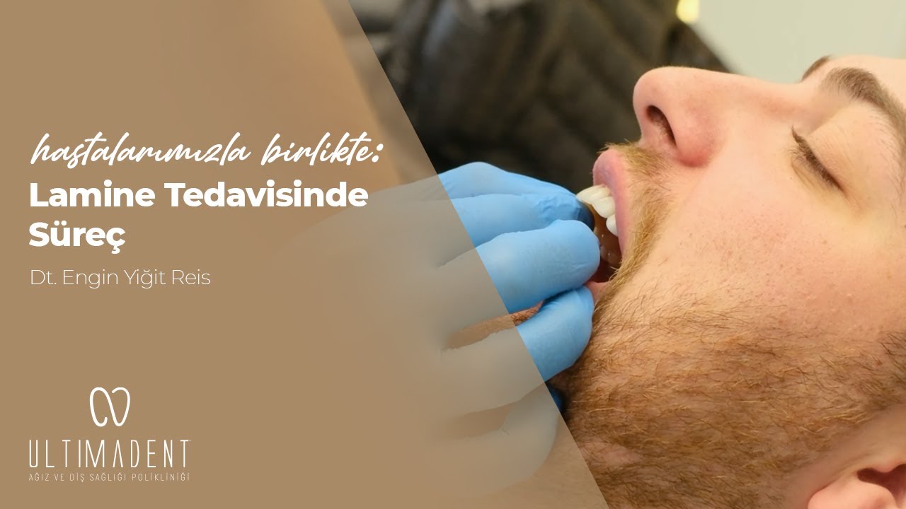 Hasta Video Lamine Tedavisinde Süreç