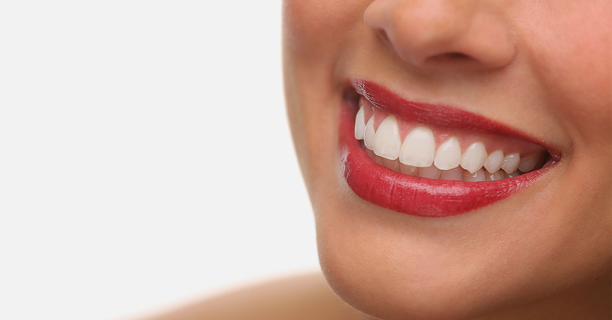Quelles interventions seront faites avec Smile Design?